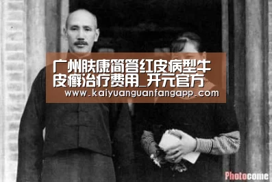 广州肤康简答红皮病型牛皮癣治疗费用_开元官方(图1) 开元竞猜